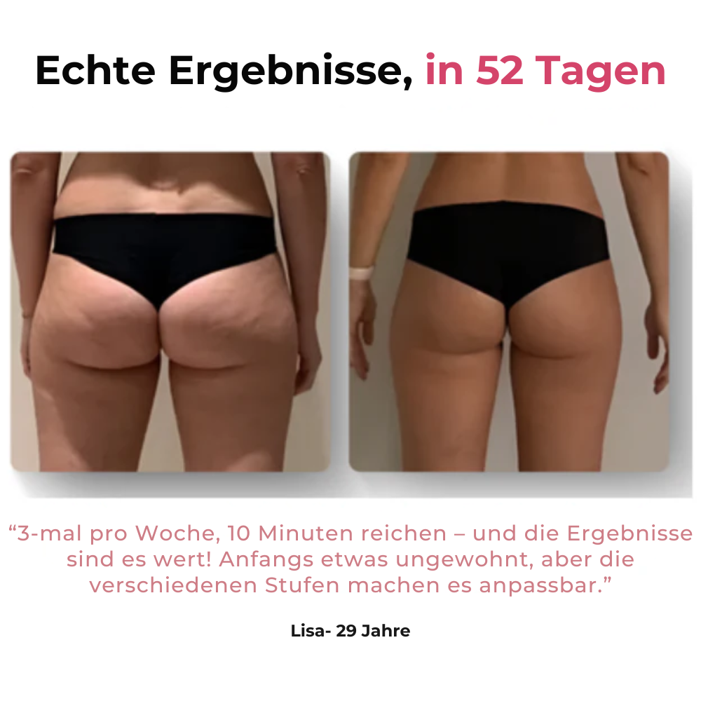 Skincys™ - Anti-Cellulite Massagegerät